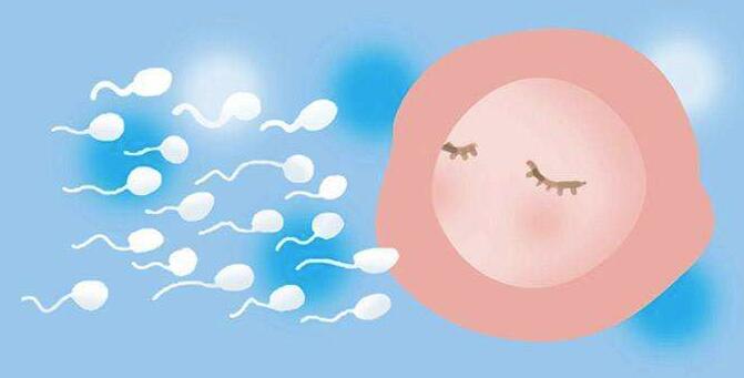 多囊卵巢综合症可以直接做赠卵试管婴儿吗？