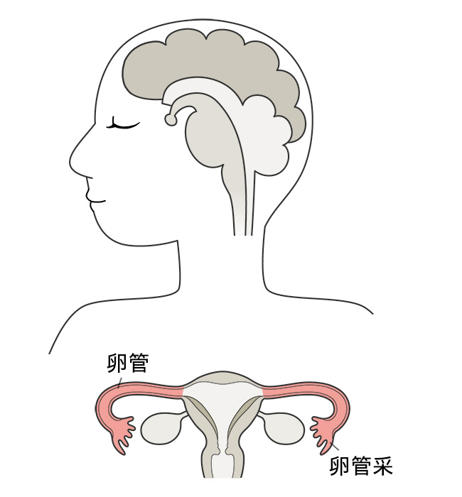 多囊卵巢综合症可以直接做赠卵试管婴儿吗？