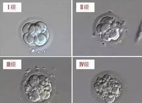 河南新乡医科大学第三附属医院供卵试管婴儿的费用
