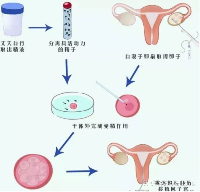 有子宫内膜异位症可以做供卵代生自怀吗？