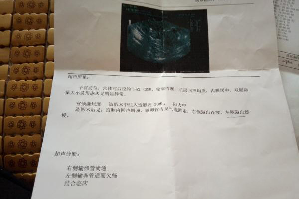 河南郑州医院赠卵试管婴儿费用