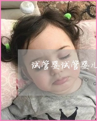 女性有压力性遗尿症能试管供卵代怀公司婴儿生育吗