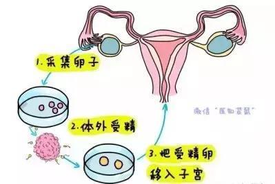 试管代怀前检查项目降调后有多少个卵泡才正常,处于这个范围才达标