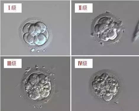 昆华医院生殖医学科宫腔粘连手术专家