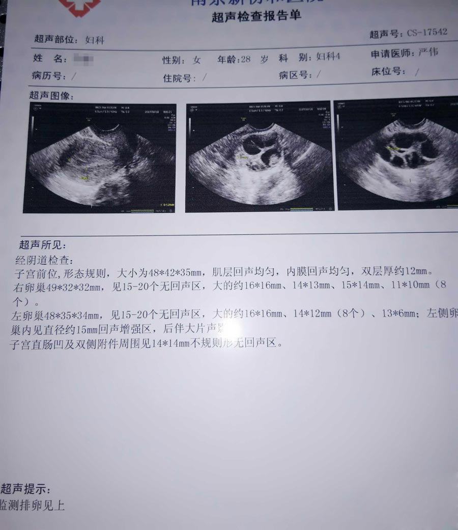代生三代供卵选性别要多少钱（如何选择助孕产子的推广计划）